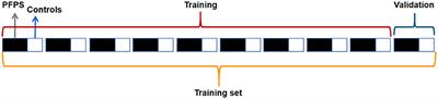 Auxiliary Diagnostic Method for Patellofemoral Pain Syndrome Based on One-Dimensional Convolutional Neural Network